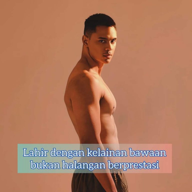 Lahir Dengan Kelainan Bawaan Bukan Menjadi Halangan Untuk Berprestasi